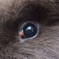 conjonctivite des yeux